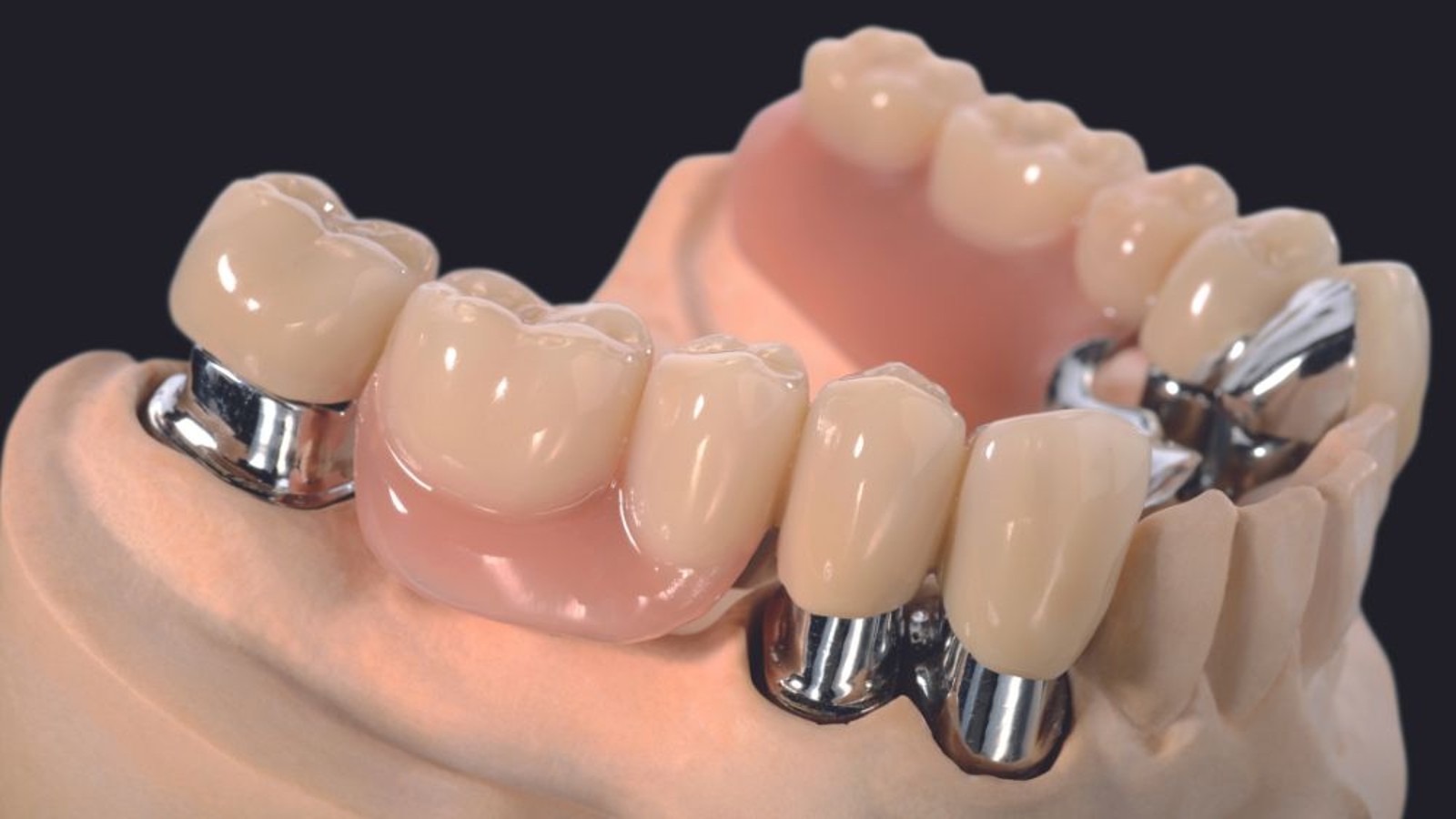 Bonnes pratiques en prothèse dentaire