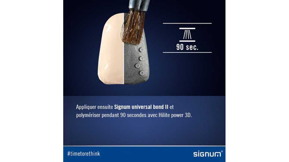 Signum® universal bond